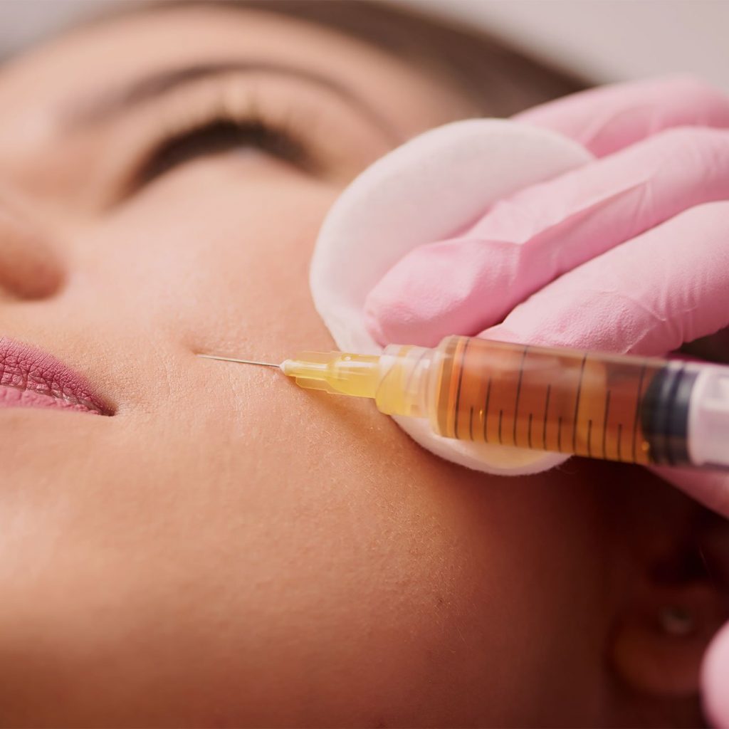 Acide hyaluronique et produits de comblement